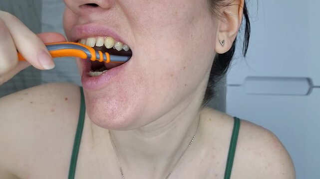 Young woman opening mouth for dental inspection at home, stomatology health check and teeth whitening concept