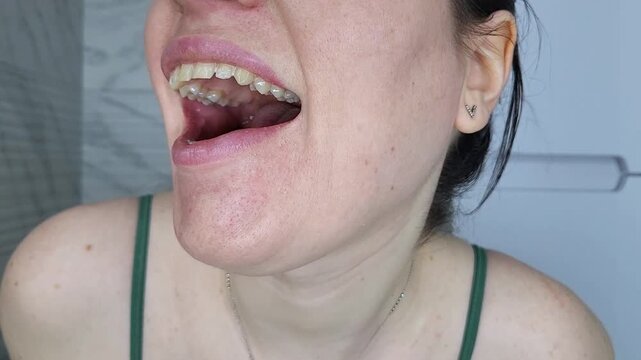 Young woman opening mouth for dental self-examination, daily oral health and hygiene morning checkup amalgam filling