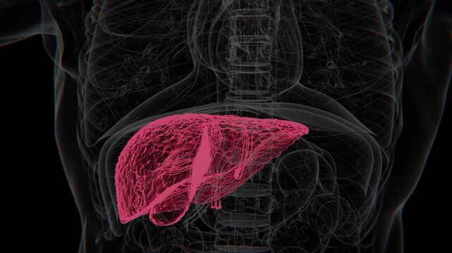 Biliary atresia is a rare condition in infants where bile ducts are blocked or absent, leading to bile buildup, liver damage, and progressive liver disease in 4K