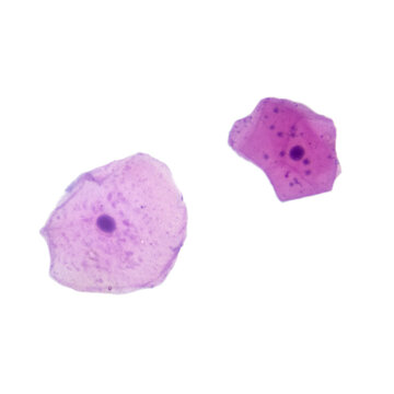 The human oral mucosa consists of stratified squamous epithelium and a deeper lamina propria. The stratified squamous epithelium serves a protective function Magnification: 400&times;.