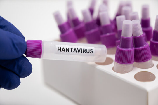 Scientis holding Hantavirus research sample vial in lab