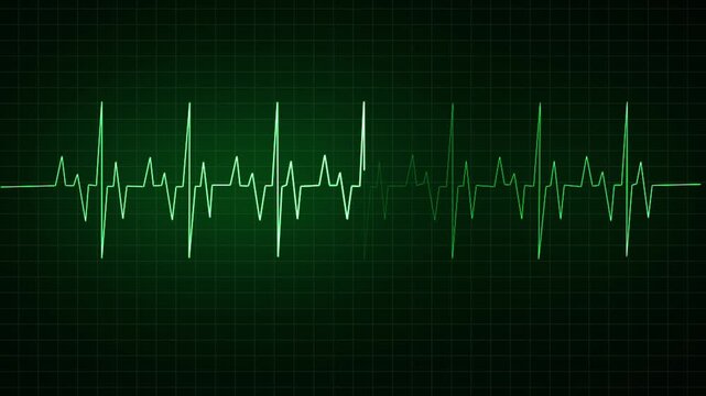 heartbeat icon animation pulses in rhythm, expanding 
ECG monitor beating heart with electrocardiogram overlay, featuring dynamic HUD elements and a   signal icon heartbeat icon animation