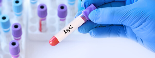 Fototapeta premium Doctor holding IgE blood test tube explaining allergy diagnosis, immunoglobulin E level assessment and evaluation of hypersensitivity reactions in clinical laboratory diagnostics