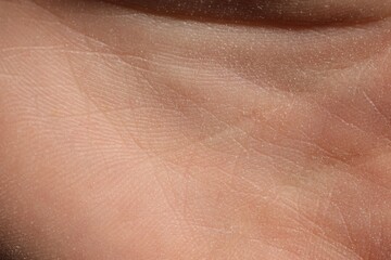 Fototapeta premium Texture of dry skin as background, closeup