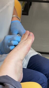 Close-up foot pedicure salon, master uses diamond drill on male foot wearing blue gloves, callus removal around heel and toes