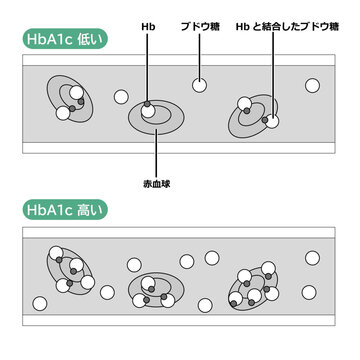 血中のヘモグロビンA1c