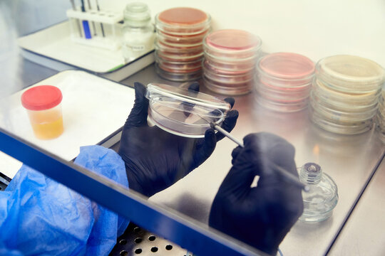 medical technologist doing urine test in medical laboratory wearing protective uniform