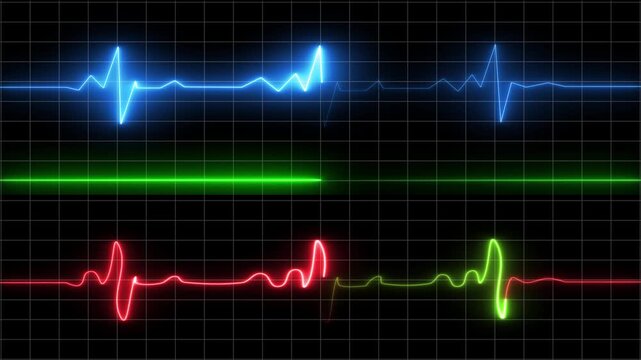 Multicolored ECG heartbeat lines on black grid background electrocardiogram medical