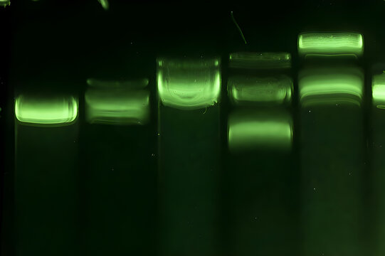 Agarose Gel Electrophoresis With Green Fluorescent DNA Bands Macro
