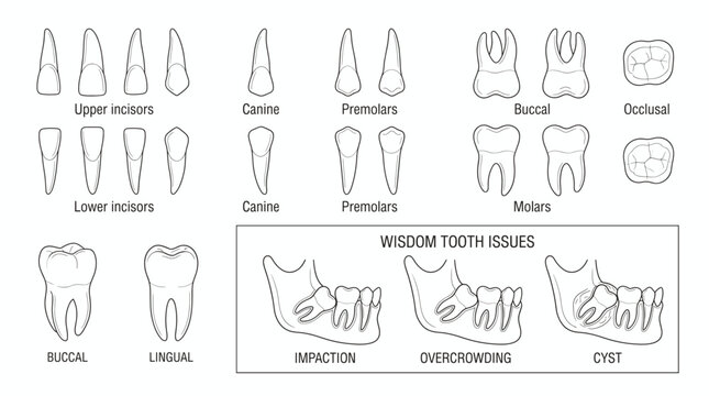 Human Dental Anatomy and Wisdom Tooth Issues Diagram