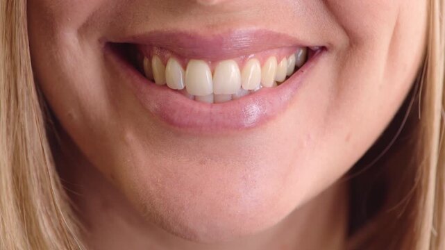 Woman, mouth and happy with teeth for oral hygiene, satisfaction and dentistry treatment for wellness. Female person, orthodontics and dental health for tooth care, fresh breath or smile for veneers.