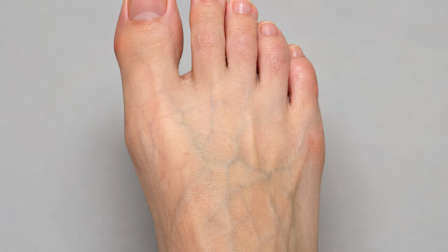 Photorealistic Lower Limb Skin with Subtle Natural Subdermal Branching Veins, Bluish Green Superficial Venous Pattern, Clinical Dermatology Close Up, Medical Teaching Image