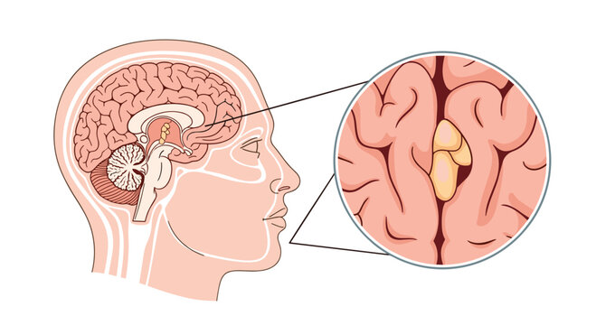 Cross section of the human head features the brain with a magnified circular view focusing on the location of the pineal gland.