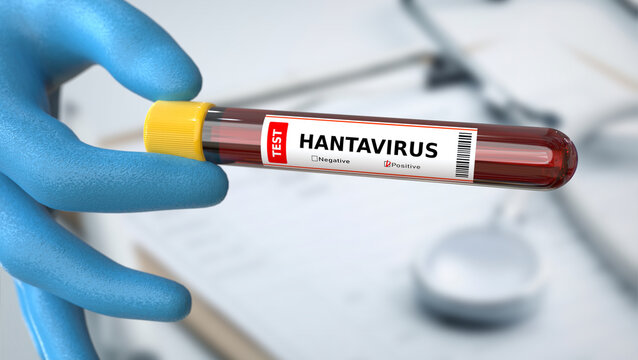 Hantavirus blood test tube in laboratory research and medical analysis setting