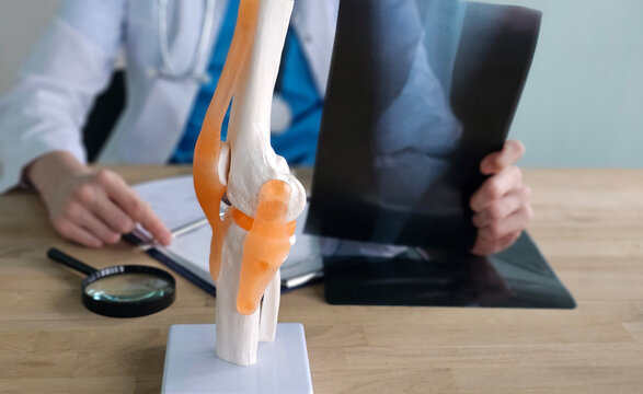 Doctor examines knee model and X-ray in medical office