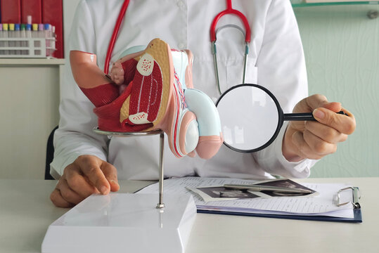 Doctors counseling patients with prostate cancer and using a penis model to show patients with prostate cancer