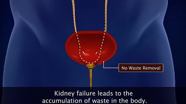 Kidney failure