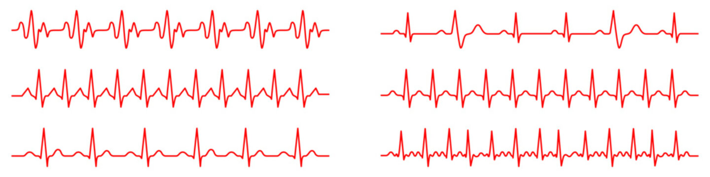 A set of red linear electrocardiogram graphs with different types of heart rhythms. Collection of medical icons reflecting pulse, arrhythmia, and vital signs. Vector illustration.