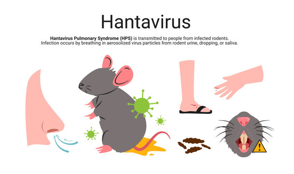 Hantavirus Pulmonary Syndrome (HPS) vector Illustration. Rodent transmission, aerosolized virus particles and public health medical awareness. Perfect for healthcare and science presentations.