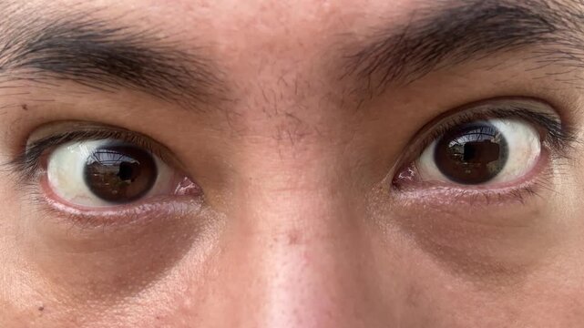 Macro View of Mans Eyes Changing From Calm to Angry Expressions