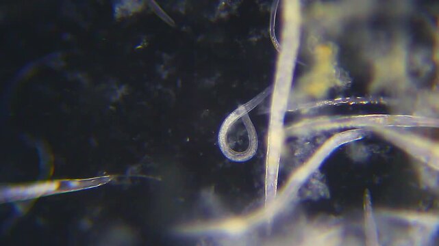 Nematodes moving slowly under 100x magnification darkfield microscopy. 4K scientific microscopy footage.