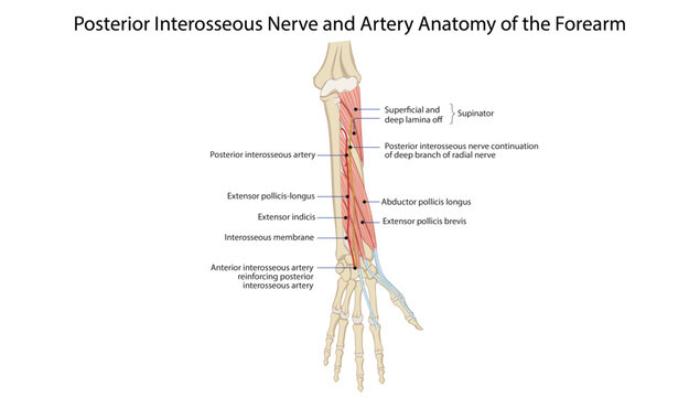 Posterior Interosseous Nerve and Artery Anatomy of the Forearm
posterior interosseous nerve, artery, supinator muscle, and deep extensor muscles.