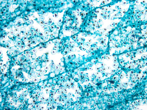 This is a micrograph of a maize seed cell. It depicts the cytological morphology of the floury endosperm.Magnify 400x
