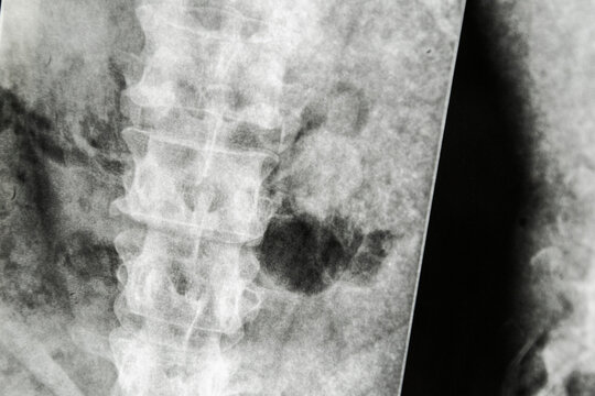 X-ray grunge medical background
