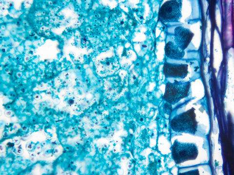 This is a micrograph of a maize seed cell. It depicts the cytological morphology of the aleurone layer. Magnification: 400x.
