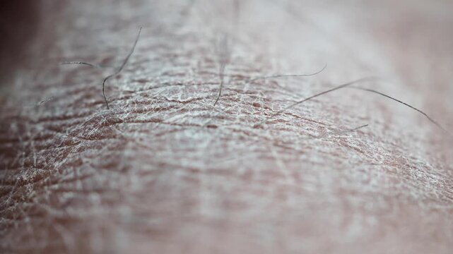Close look at human dry skin and hair texture in daylight