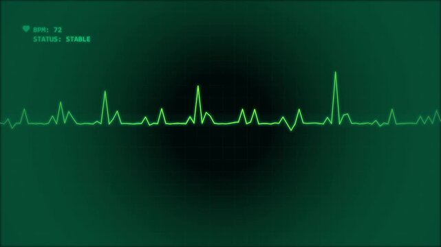 Heart rate monitor display showing fluctuating cardiac rhythm and beats