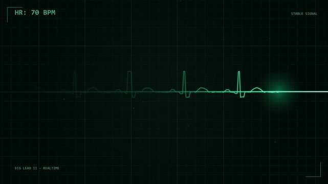 Medical heart rate monitor displaying live ecg pulse on dark grid screen