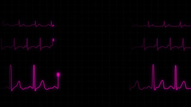 Digital electrocardiogram display showing a continuous pink glowing heartbeat waveform on a black grid background, simulating a medical heart monitor oscilloscope for health data visualization