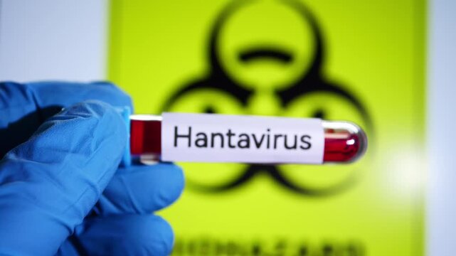 Hand in blue gloves holding a blood test tube labeled Hantavirus against a biohazard sign.