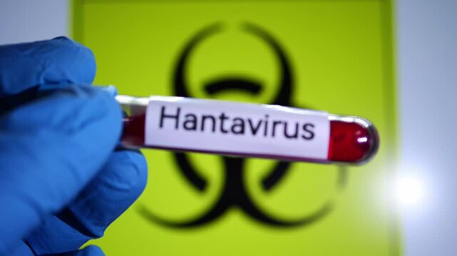 Hand in blue gloves holding a blood test tube labeled Hantavirus against a biohazard sign.