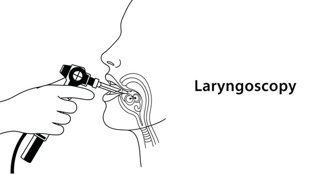 Laryngoscopy medical procedure concept, minimalist line art illustration of doctor performing throat examination with endoscope, ENT diagnostic tool vector.