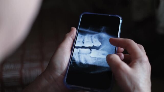 An unrecognizable woman looks at a close-up of a CT scan of her teeth. A wisdom tooth is visible in the frame.