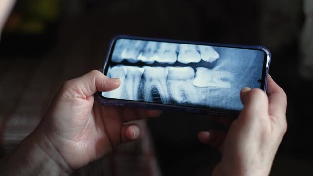An unrecognizable woman looks at a close-up of a CT scan of her teeth