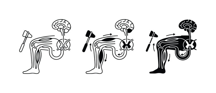 Neurological Reflex Arc Diagram, Human Nervous System, Medical Science Illustration