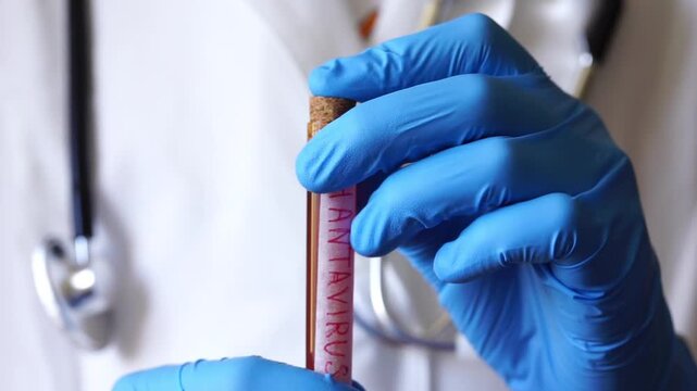 Hantavirus blood test tube doctor hands blue gloves white medical coat background stethoscope healthcare diagnostics clinical laboratory analysis concept of healthcare, medicine, science