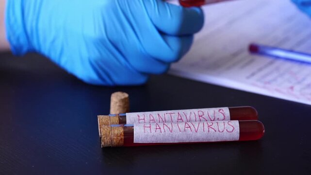 Hantavirus blood sample test tubes doctor hands blue gloves medical laboratory research surface pandemic clinical report with copy space for banner design concept of healthcare, medicine, science