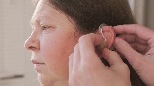 assistant fitting modern behind-the-ear hearing aidfemale ear, auditory perception, audiological hearing support, sound device, professional healthcare assistance, Technological progress ENT medicine