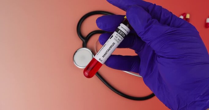 Hand with protective glove holding a Hantavirus specimen vial on a red gradient background for infectious disease research videos.