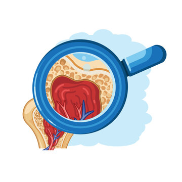 Bone Marrow Structure Under Magnifying Glass Medical Illustration