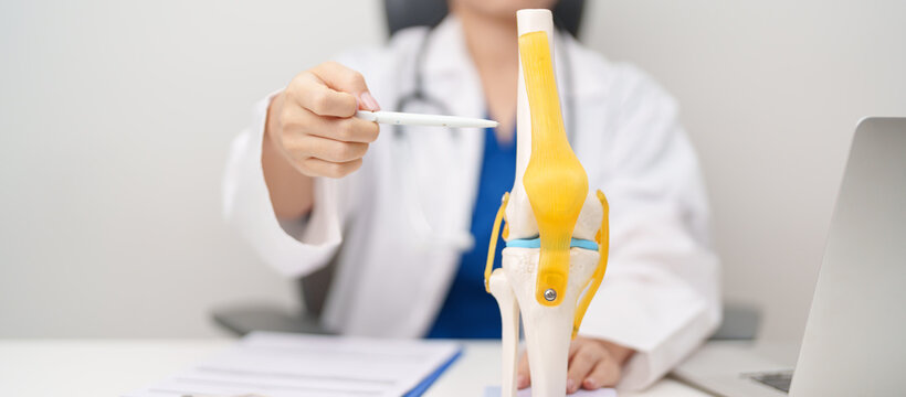Doctor with Human Knee joint anatomy model. Osteoarthritis, Patellofemoral Pain Syndrome, Patellar Tendinitis, ACL, Anterior Cruciate Ligament, PCL, Posterior, MCL, Medial Collateral, LCL and Lateral