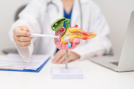 Doctor with human Pancreatitis anatomy model with Pancreas, Gallbladder, Bile Duct, Duodenum, Small intestine. Pancreatic cancer, Acute and Chronic pancreatitis, Digestive system and Health concept