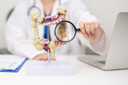 Doctor with human Colon anatomy model. Colonic disease, Large Intestine, Colorectal cancer, Ulcerative colitis, Diverticulitis, Irritable bowel syndrome, Digestive system and Healthcare concept