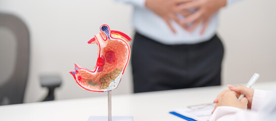 Doctor with Gastric anatomy model. Gastroenterologist consultation, stomach diseases and ulcers,...