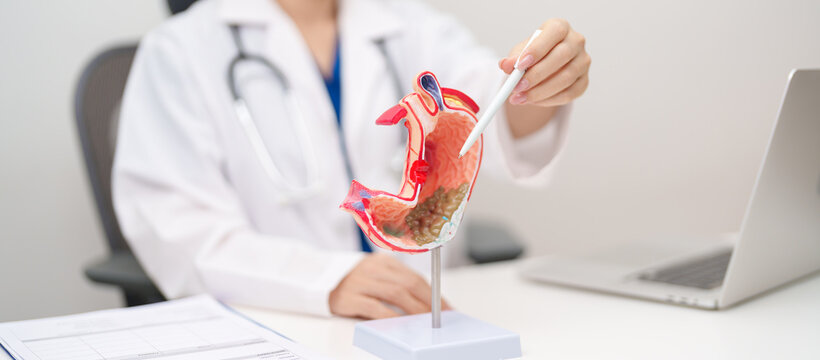 Doctor with Gastric anatomy model. Gastroenterologist consultation, stomach diseases and ulcers, November stomach cancer, Gastroesophageal Reflux Disease, GERD, Acid reflux and healthcare medical