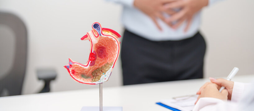 Doctor with Gastric anatomy model. Gastroenterologist consultation, stomach diseases and ulcers, November stomach cancer, Gastroesophageal Reflux Disease, GERD, Acid reflux and healthcare medical